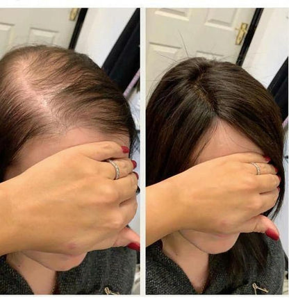 FEG PLUS+ Hair Growth Spray